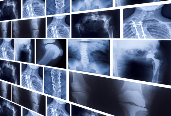 Image of Barium or Application