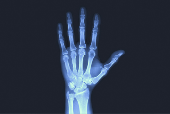 Image of Thulium or Application